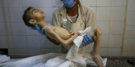 استشهاد طفل فلسطيني بسبب الجوع في غزة