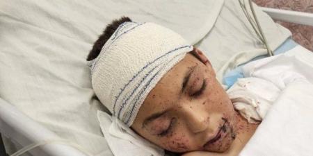 إيطاليا ستستقبل طفلًا فلسطينيًا نجا من القصف الإسرائيلي الأسبوع المقبل