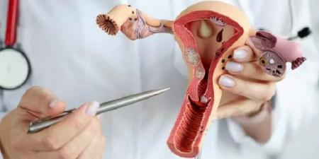 علامات لا يجب تجاهلها..تكيس المبايض قد يؤثر على حياتك