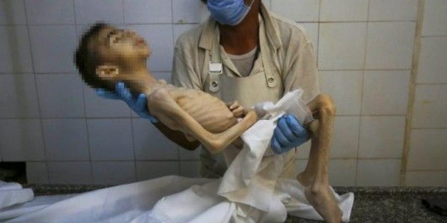 استشهاد طفل فلسطيني بسبب الجوع في غزة