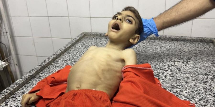 استشهاد طفل جوعا في غزة