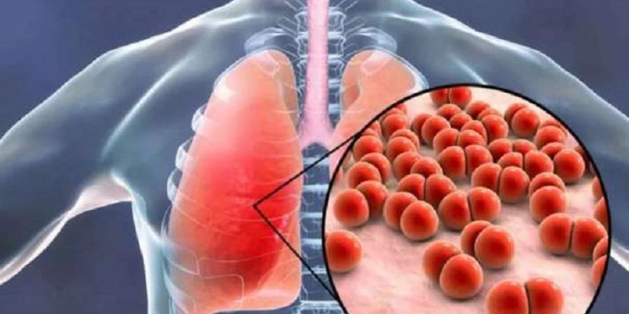 آلية جزيئية جديدة تكشف سرّ تخفي بكتيريا السل وتفتح آفاق العلاج