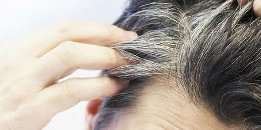 هل يمكن تأخير الشيب؟ هذه العوامل تسرّع ظهوره ونصائح لإبطائه